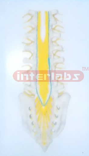 HUMAN CAUDA EQUINE AND ACANTHA NERVES IN LUMBAR AND SACRUM